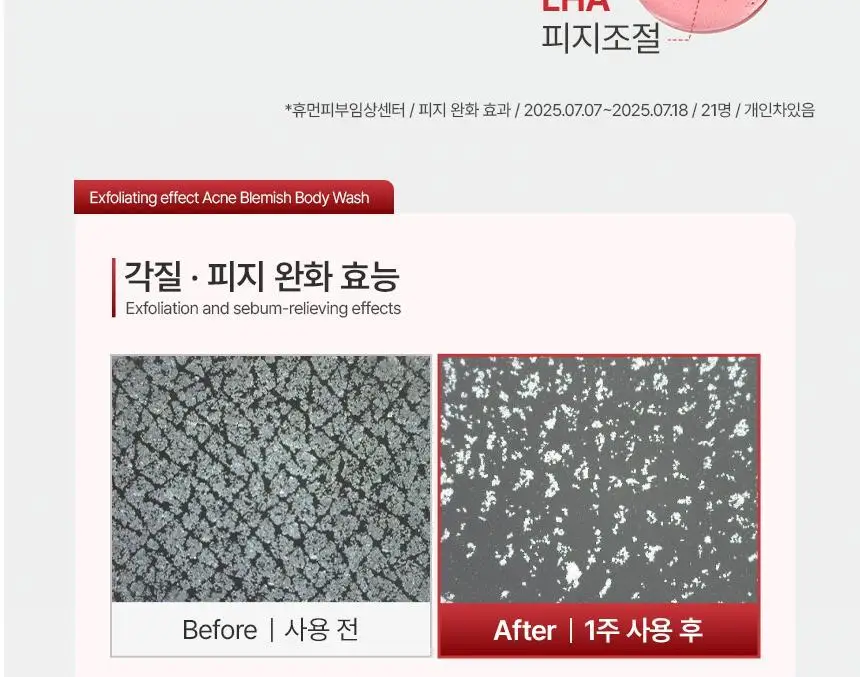 [1위 올인원 바디워시] 노도르 바디워시 460ml 3종 택 1 (올인원 / 아크네 / 모이스춰) 상세페이지 70